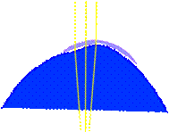 http://lynntest.co.uk/wp-content/uploads/image/Images/Irreg%20cornea%20and%20small%20rgp%20light%20rays.png