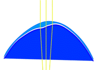 http://lynntest.co.uk/wp-content/uploads/image/Images/Irreg%20Cornea%20and%20soft%20lens%20light%20rays(1).png